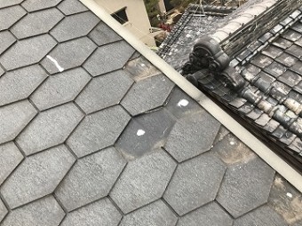 応急処置