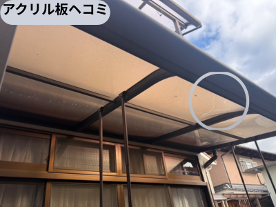 アクリル板ヘコミ